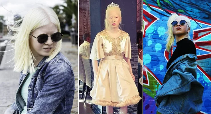 FOTOS: Conoce a Xueli, modelo de Vogue que fue abandonada de bebé por ser albina