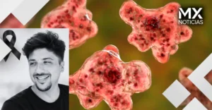 Confirman en Yucatán primera muerte relacionada con ameba “comecerebros”