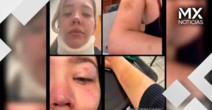 “Temí que me matara”: joven denuncia brutal agresión de su padre con un machete en Jalisco